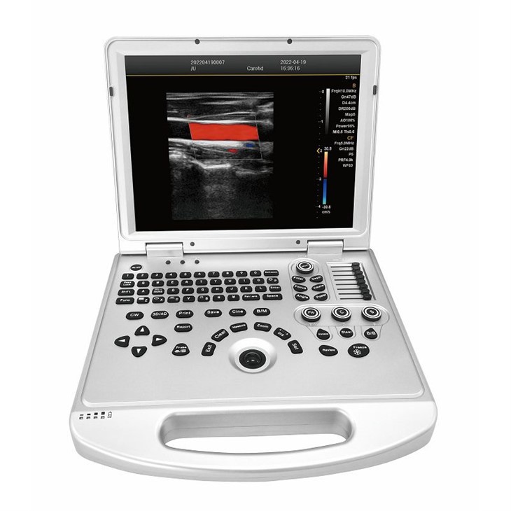 15-inch Portable Color Ultrasound suppliers