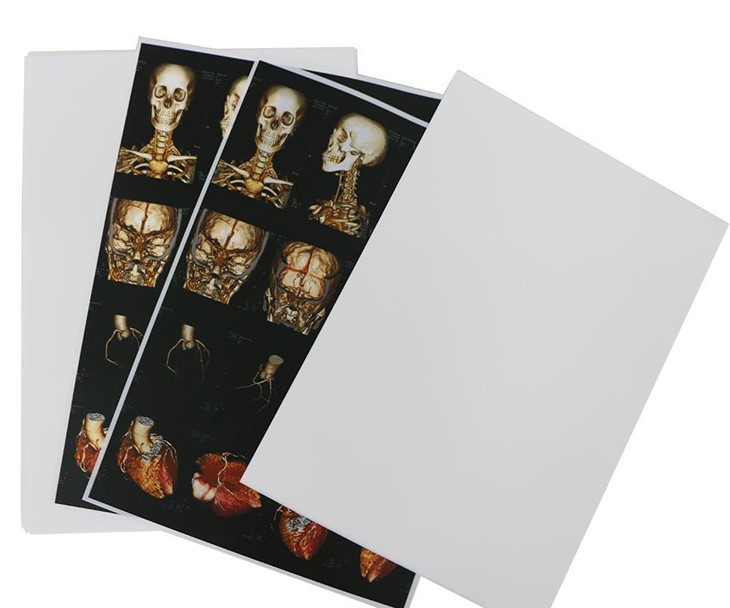 Medical Inkjet Film Laser Printer Medical Dry Film X-ray Film best