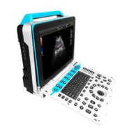 Käru värvi Doppleri ultraheli